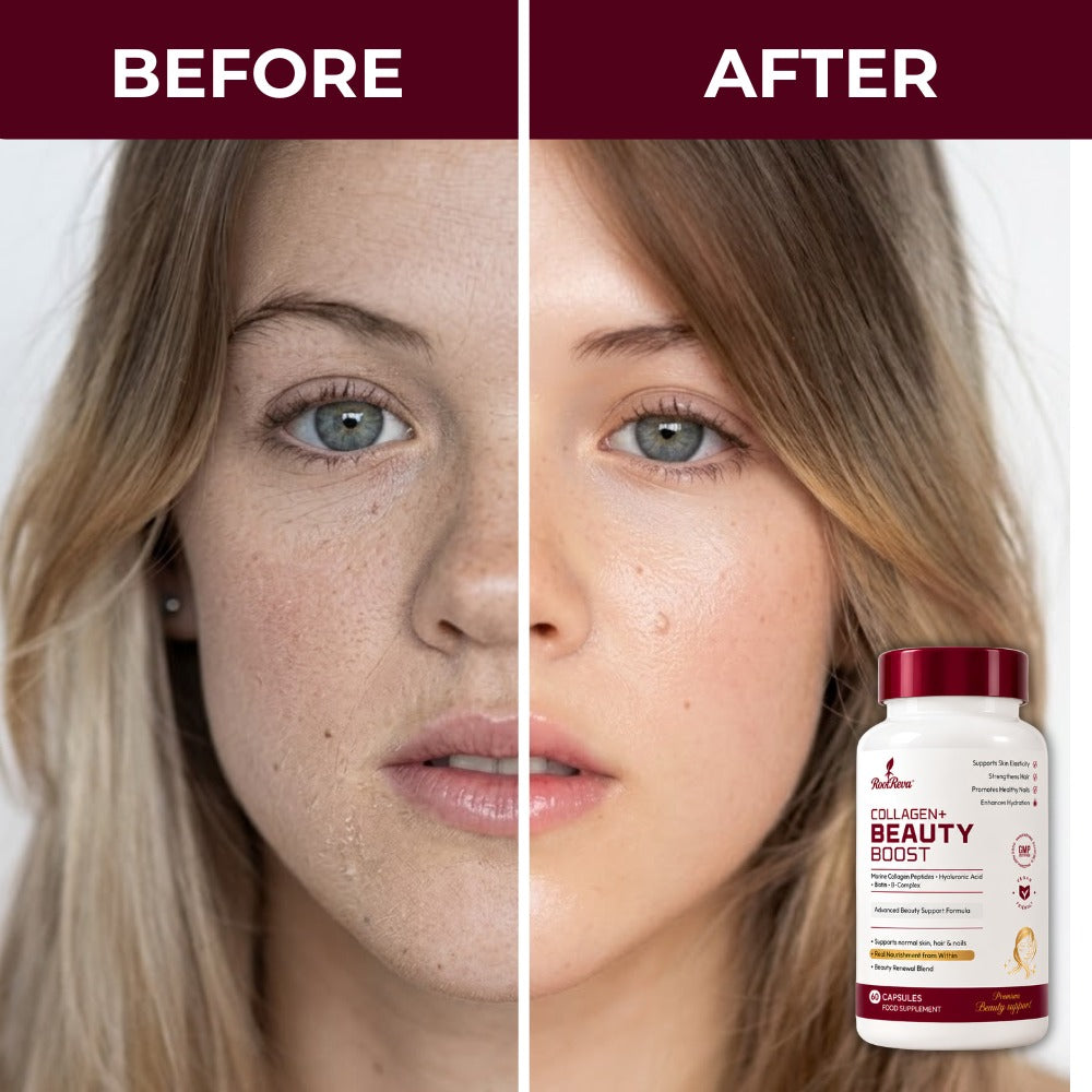 Side-by-side before and after photographs of a face, shown next to RootReva Collagen+ Beauty Boost
