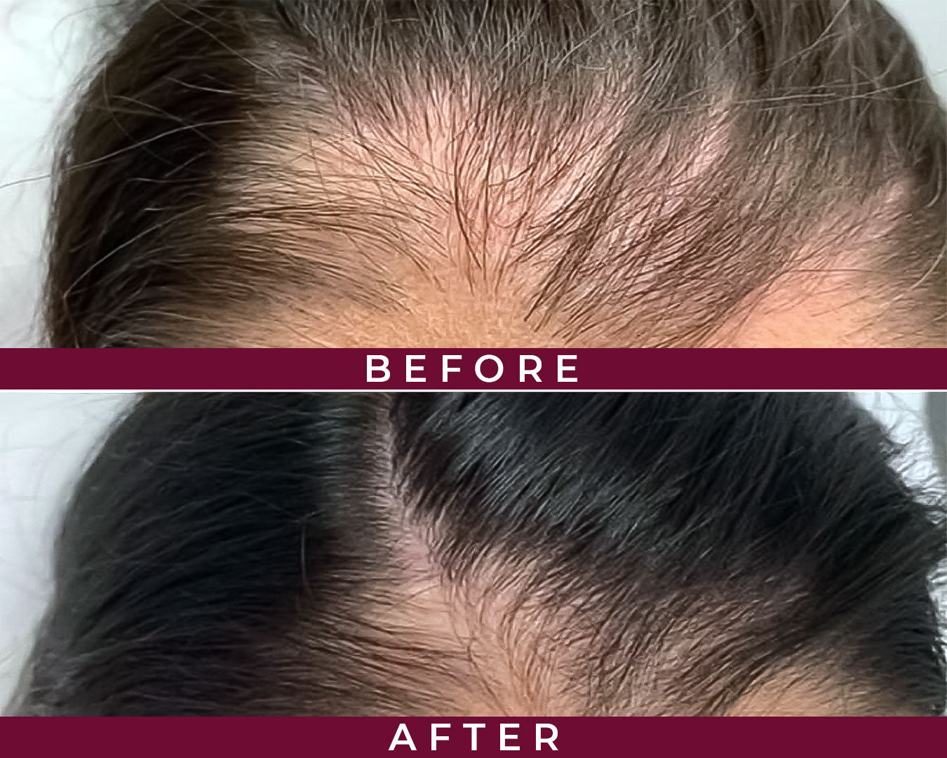 Biotin Hair Boost Complex